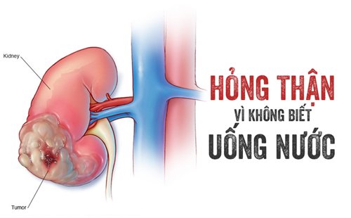 nhung-sai-lam-uong-nuoc-khien-than-hu-hong-nang.png