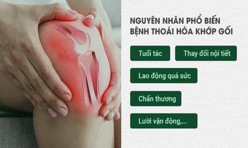 nguyen-nhan-thoai-hoa-khop-goi.jpg