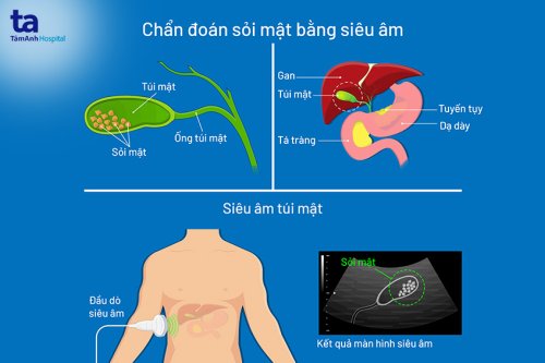 sieu-am-soi-mat.jpg