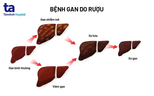 xo-gan-ruou.jpg